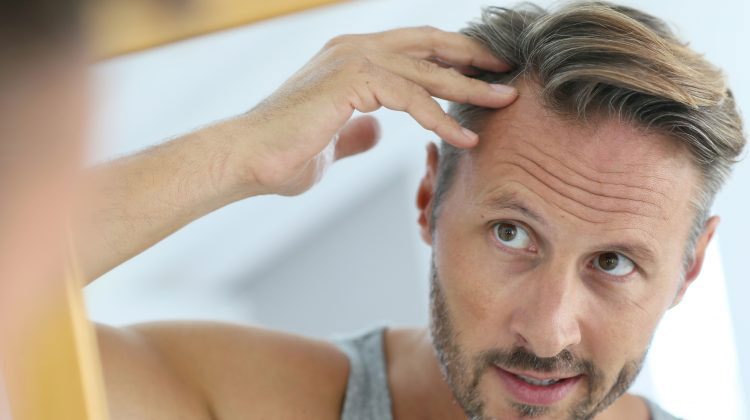 چگونه از ریزش مو در مردان و زنان جلوگیری کنیم
